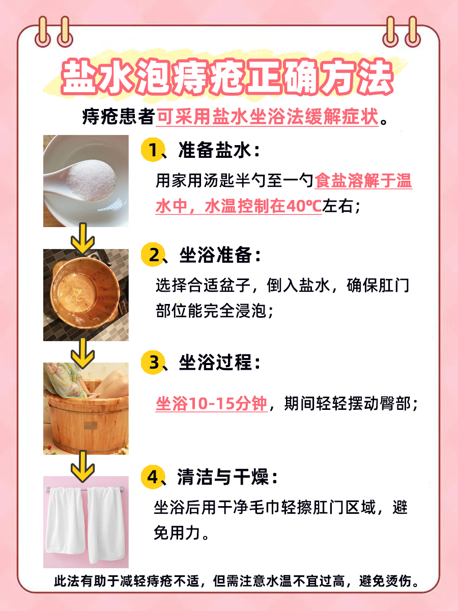 盐水坐浴：痔疮缓解的简易疗法