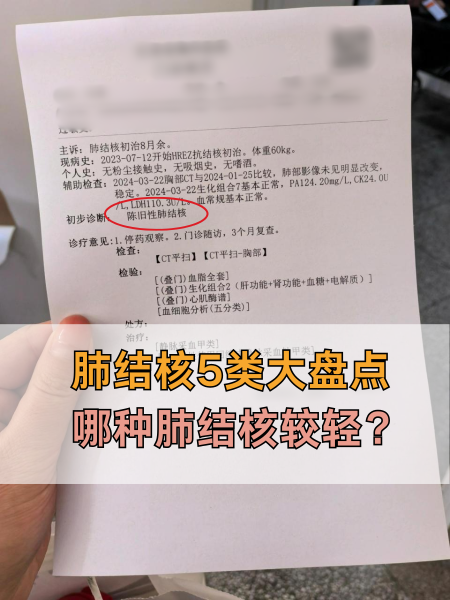 肺结核5类大盘点，哪种肺结核较轻？