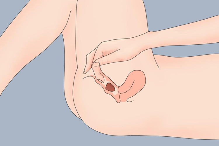 食指推入栓剂图