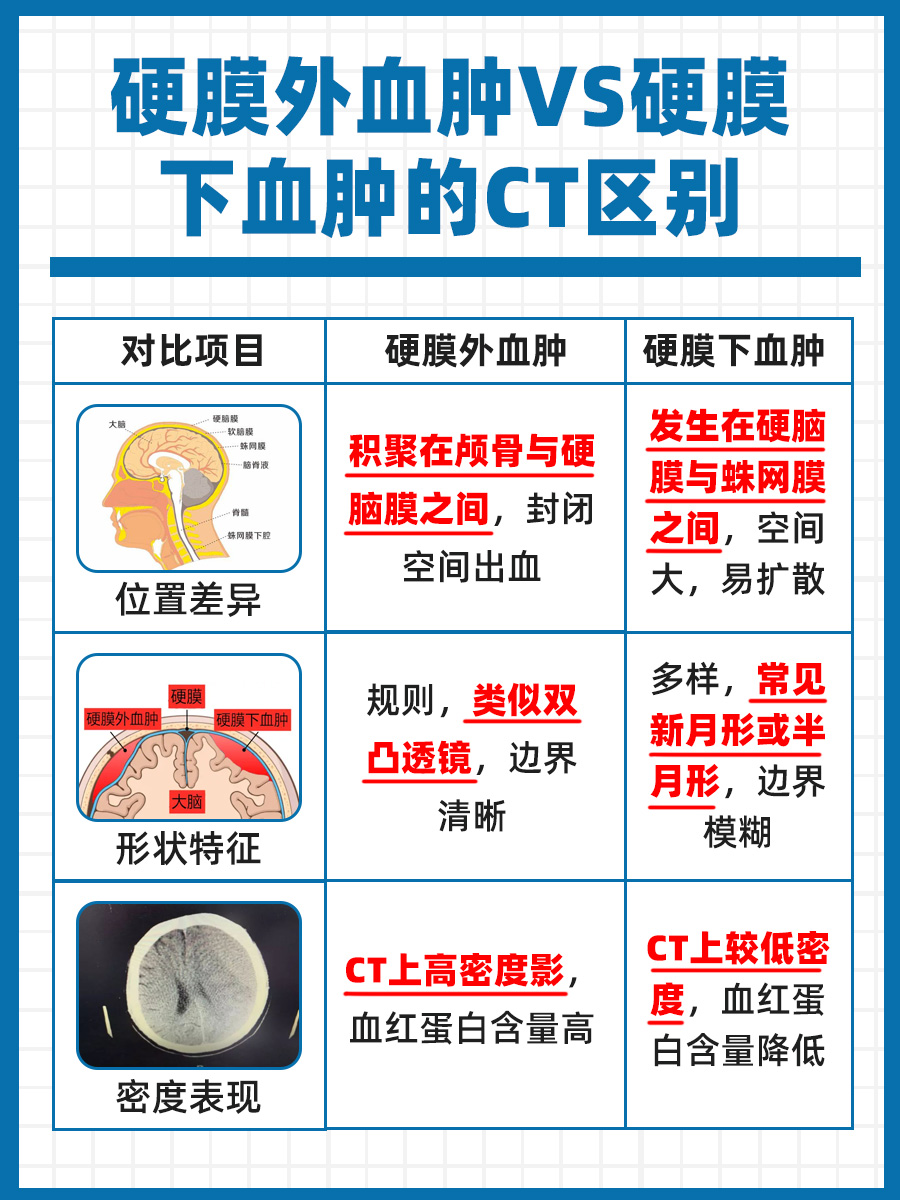 CT诊断：硬膜外血肿与硬膜下血肿的区别