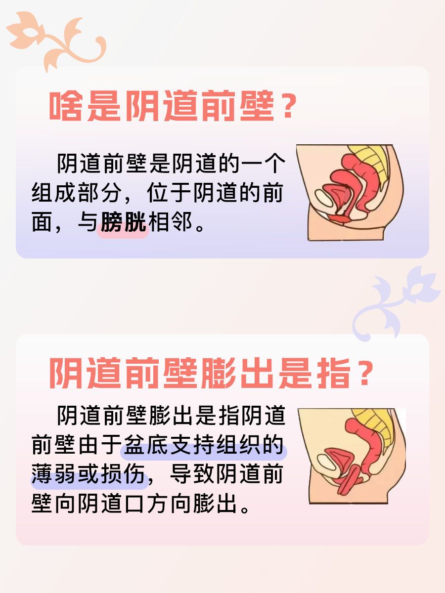 一文带你了解阴道前壁膨出的那些事儿！
