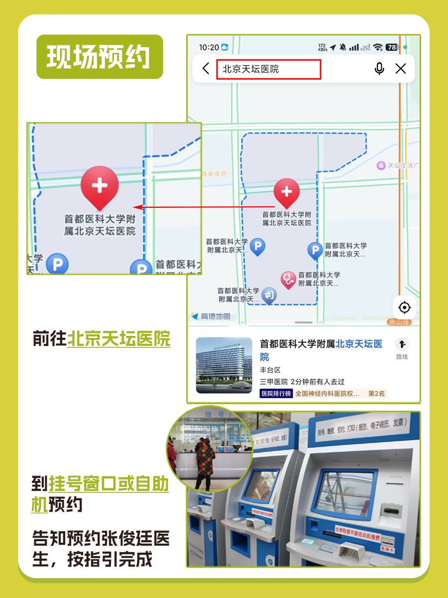 北京天坛医院张俊廷医生怎么样？怎么挂号？