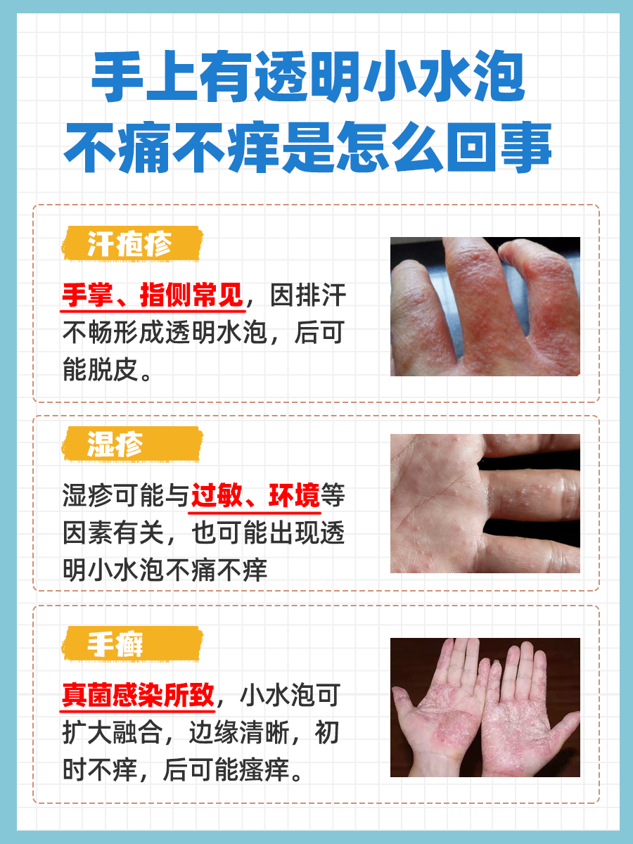 手上有透明小水泡不痛不痒的原因？你知道吗