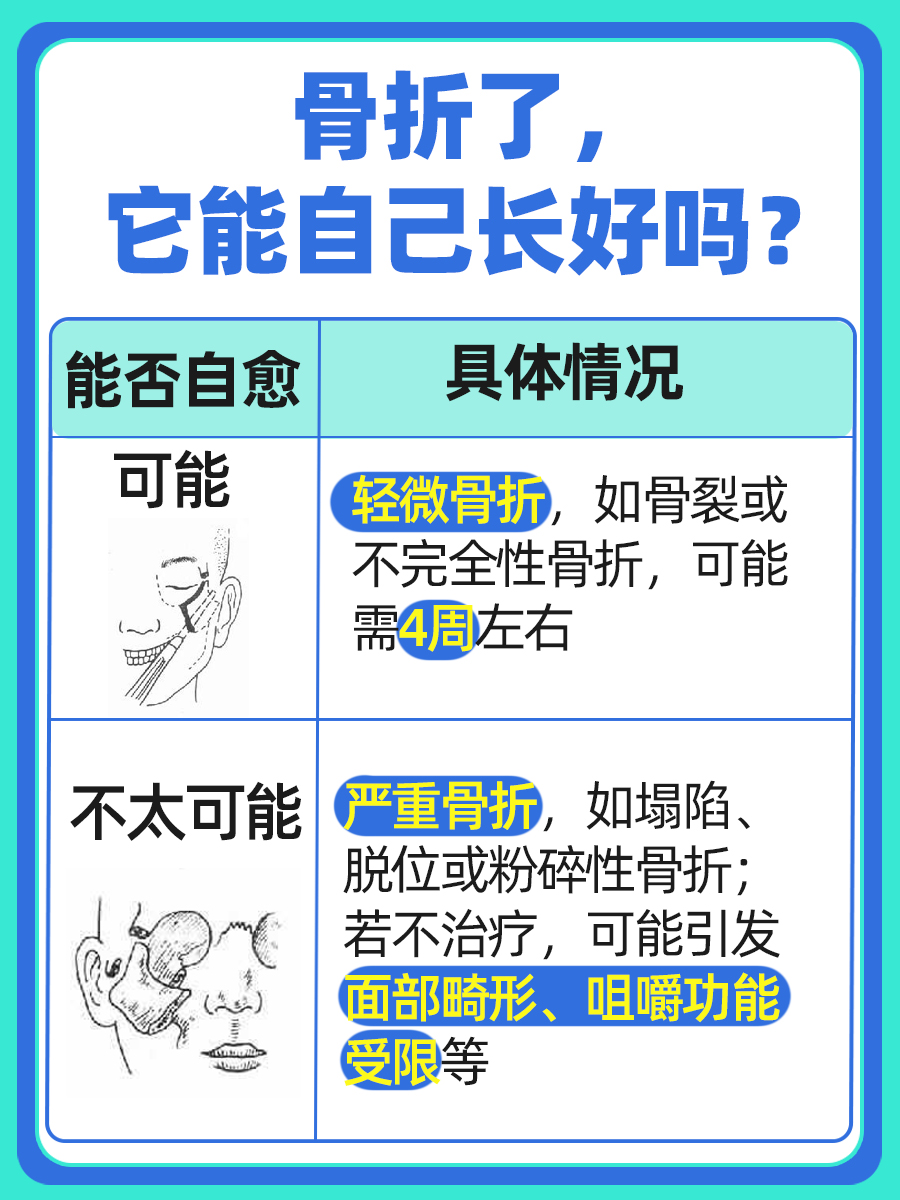 颧骨遭遇不测，骨折了，它能自己长好吗？