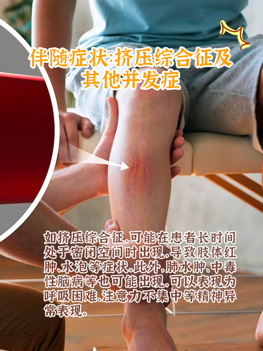 冬季取暖警惕一氧化碳中毒，要先了解这些症状