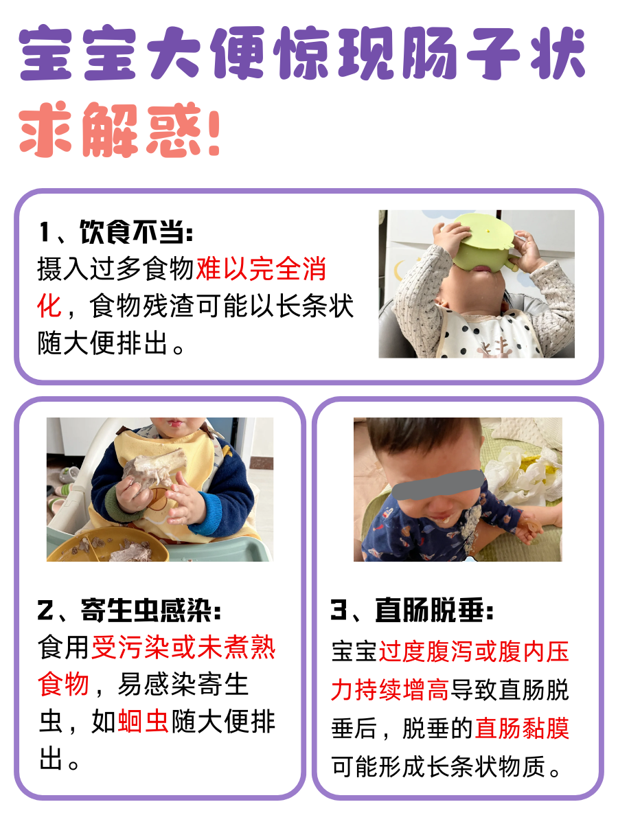宝妈必看！宝宝大便异常像肠子？
