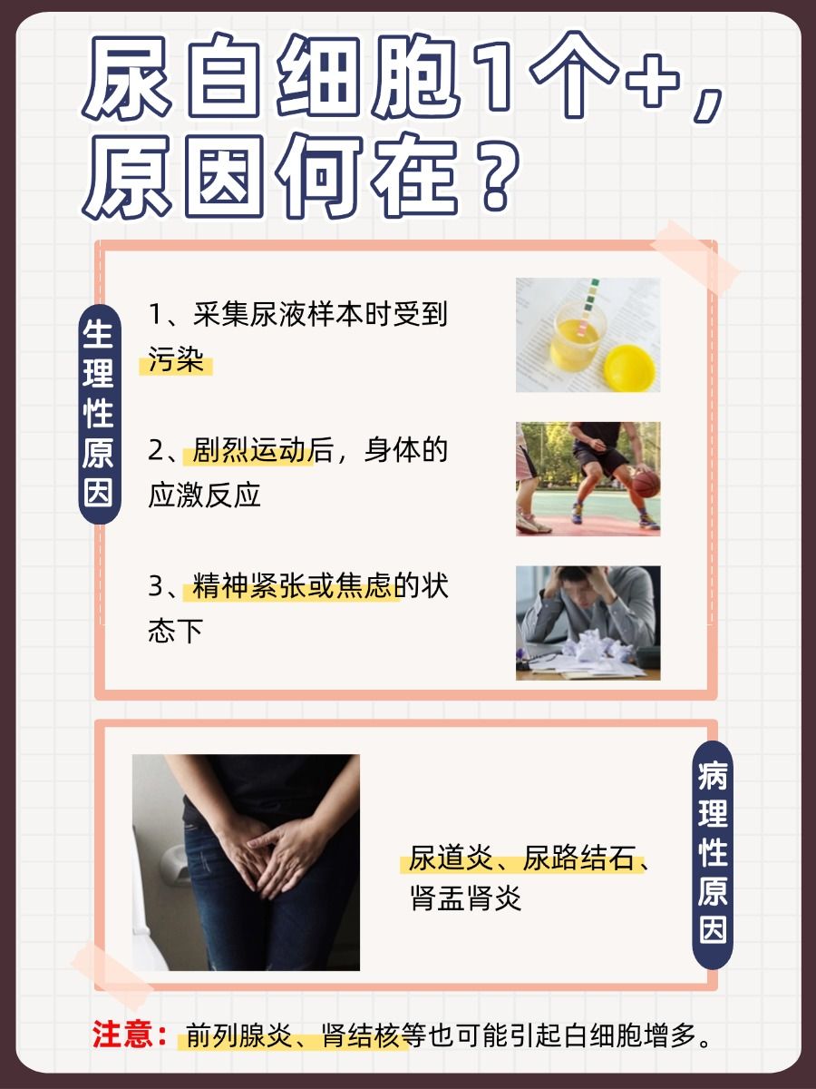 尿白细胞1个+,身体究竟遭遇了什么?