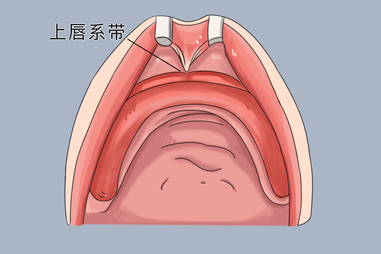 上唇系带照片图片