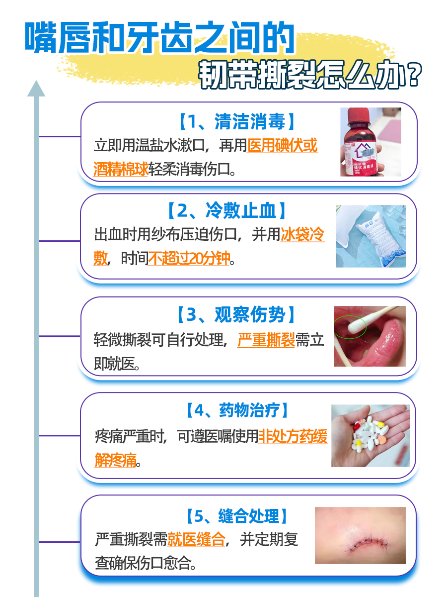 韧带撕裂发生在唇齿间？别急，这里有解决方案！