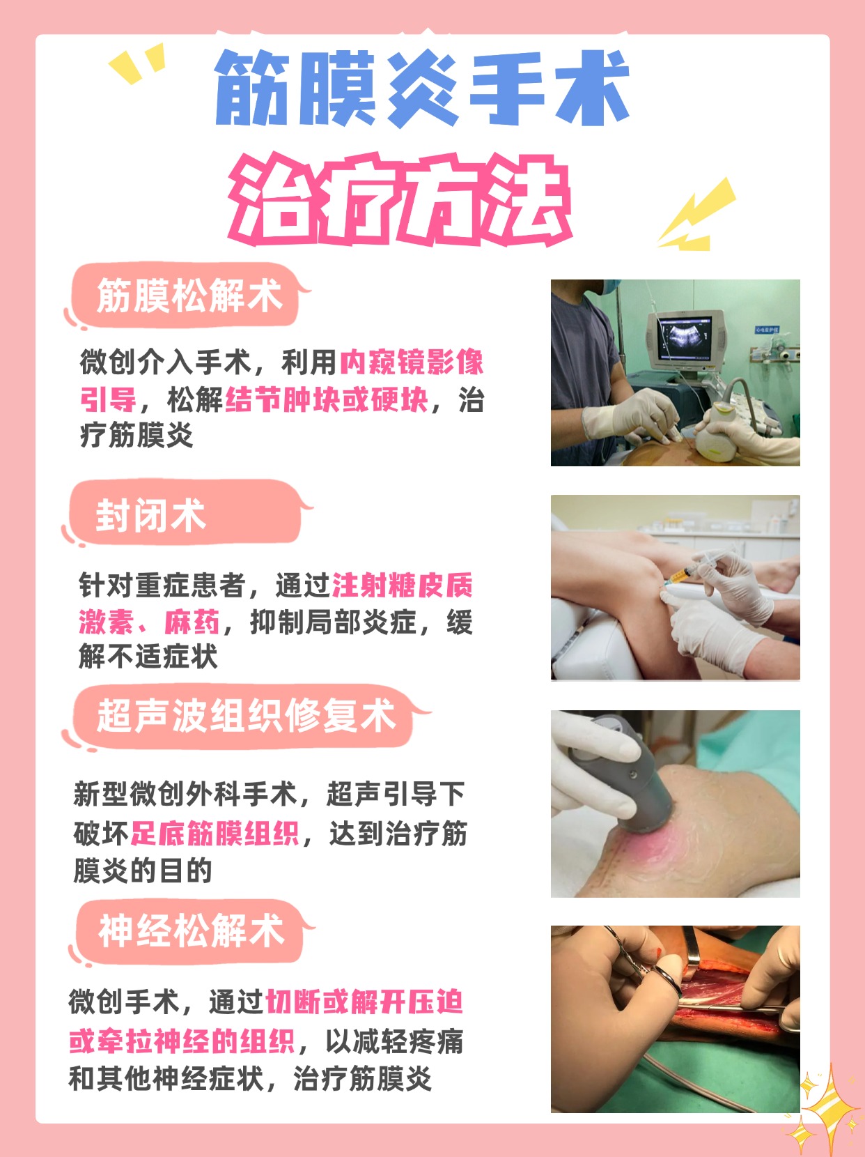 带你了解,筋膜炎手术怎么治疗