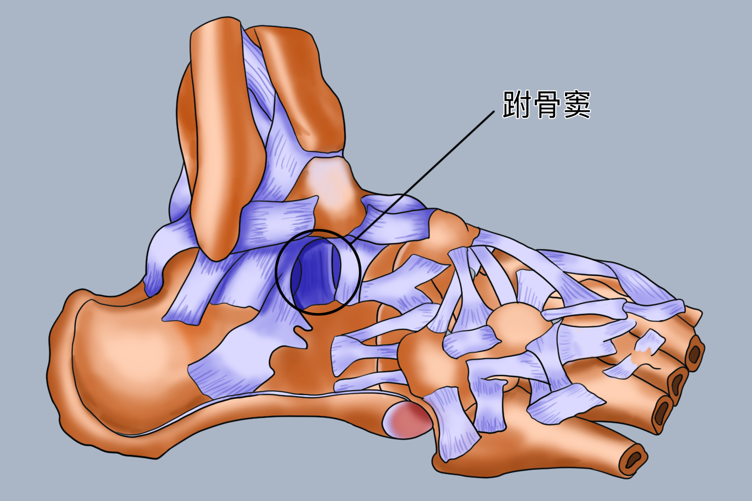 脚踝跗骨窦位置图