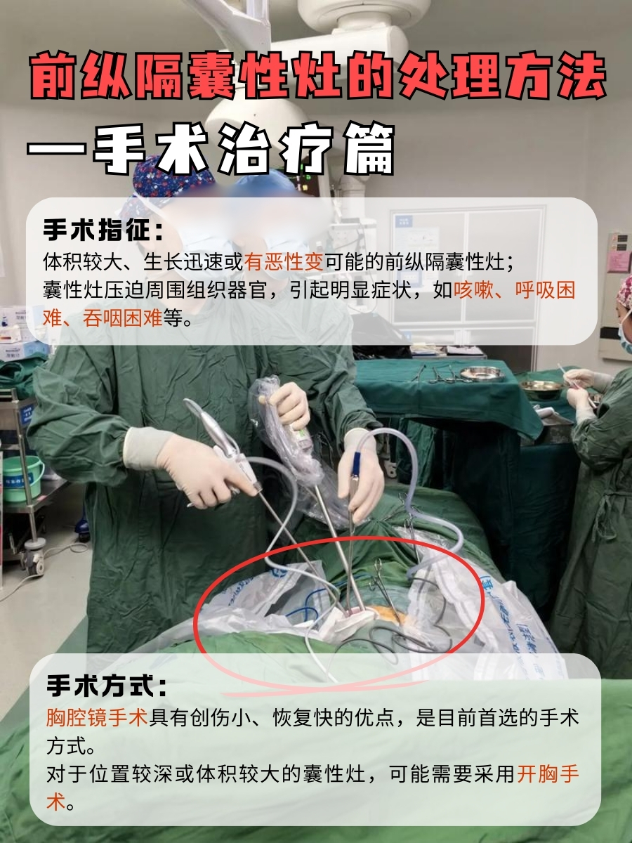 医学新知，前纵隔囊性灶是什么东东？