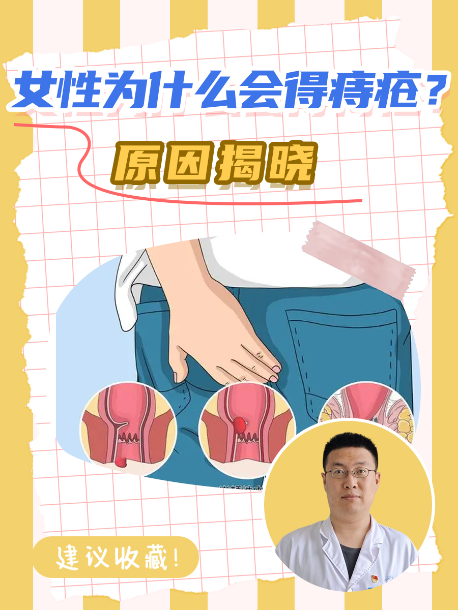 女性为什么会得痔疮?原因揭秘