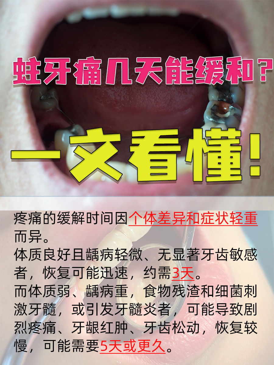 蛀牙痛几天能缓和?一文看懂!