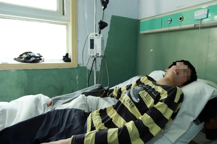 马方综合征全身图 马方综合征全身图