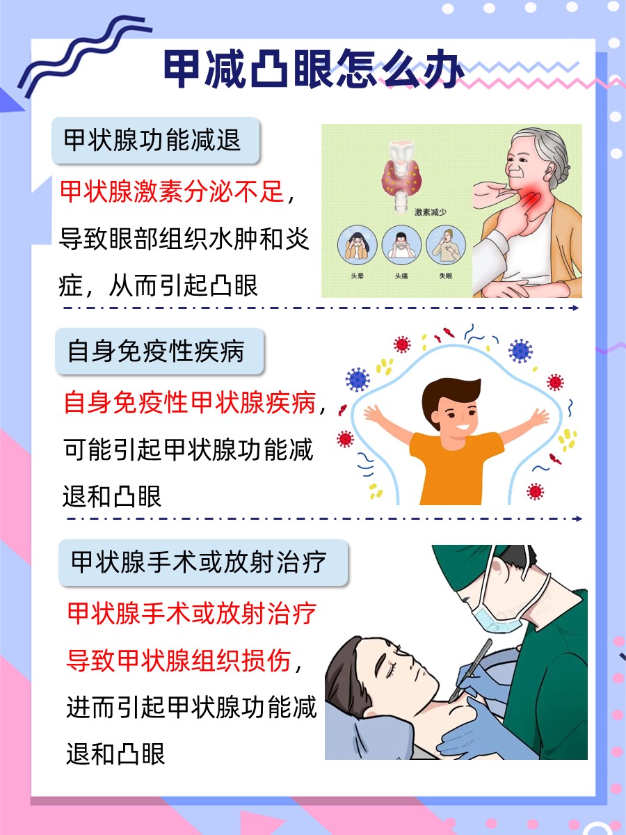 甲减引发的凸眼困扰，医生告诉你如何应对！