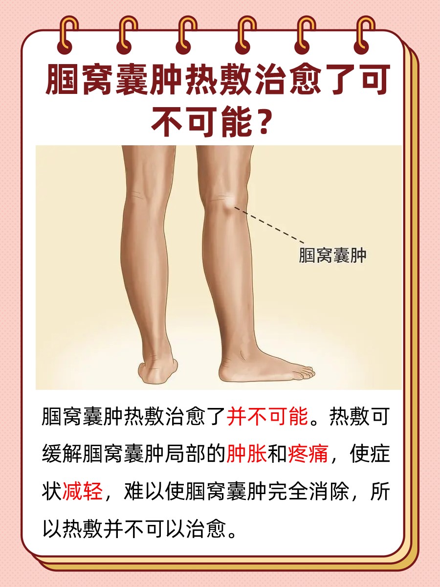 你知道多少：腘窝囊肿热敷治愈了可能吗？