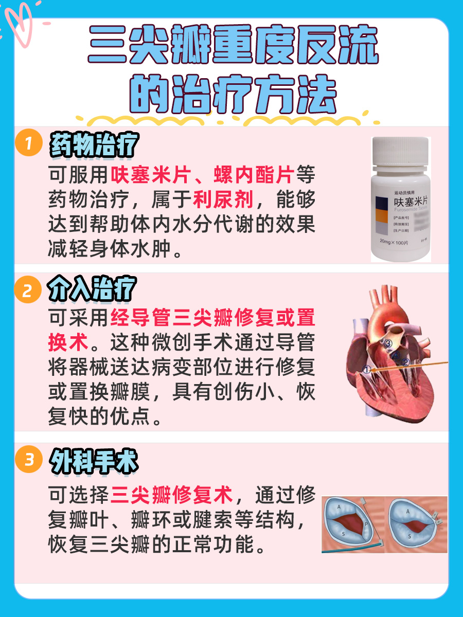 三尖瓣重度反流,其影响大揭秘