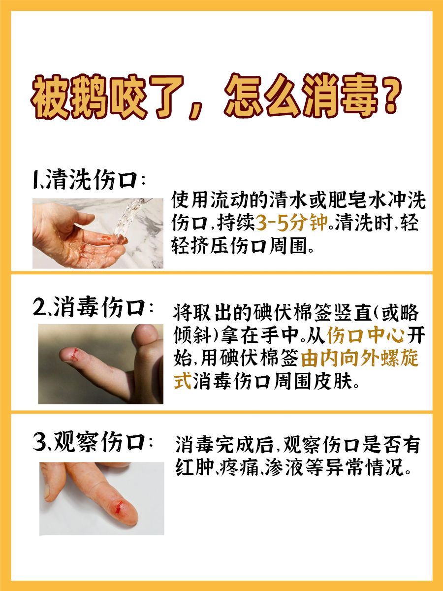 被鹅咬了，需要打针吗？快速了解！