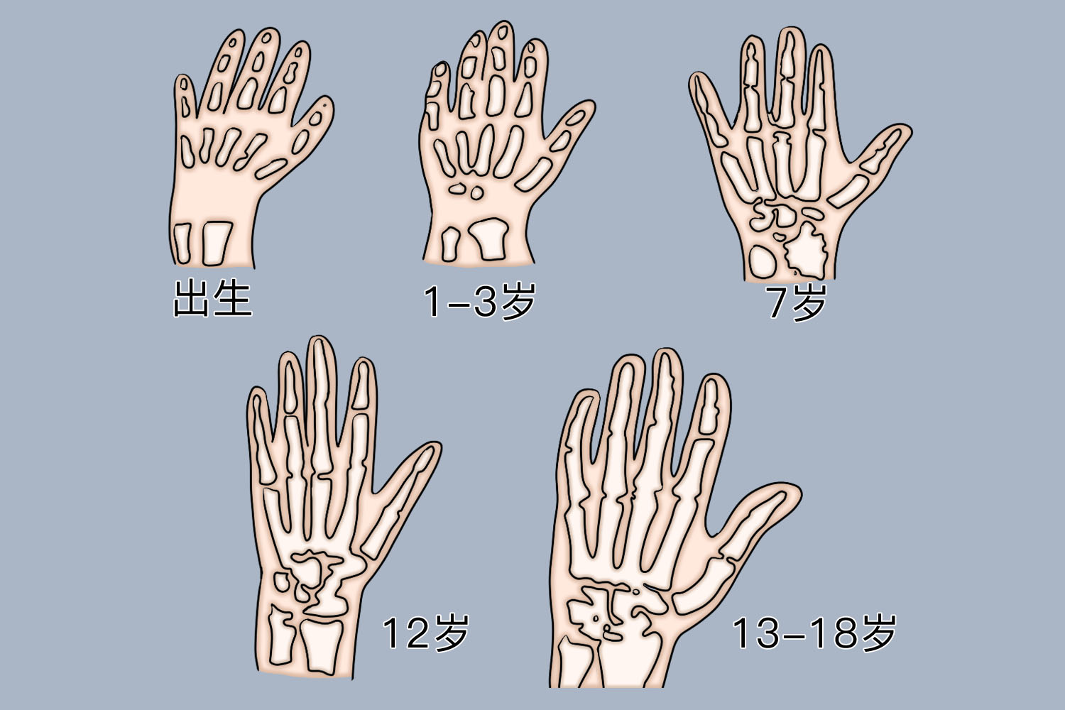 儿童手部骨骼发育图