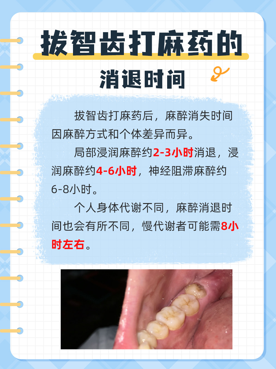 揭秘！拔智齿后麻药消失的时间轴！