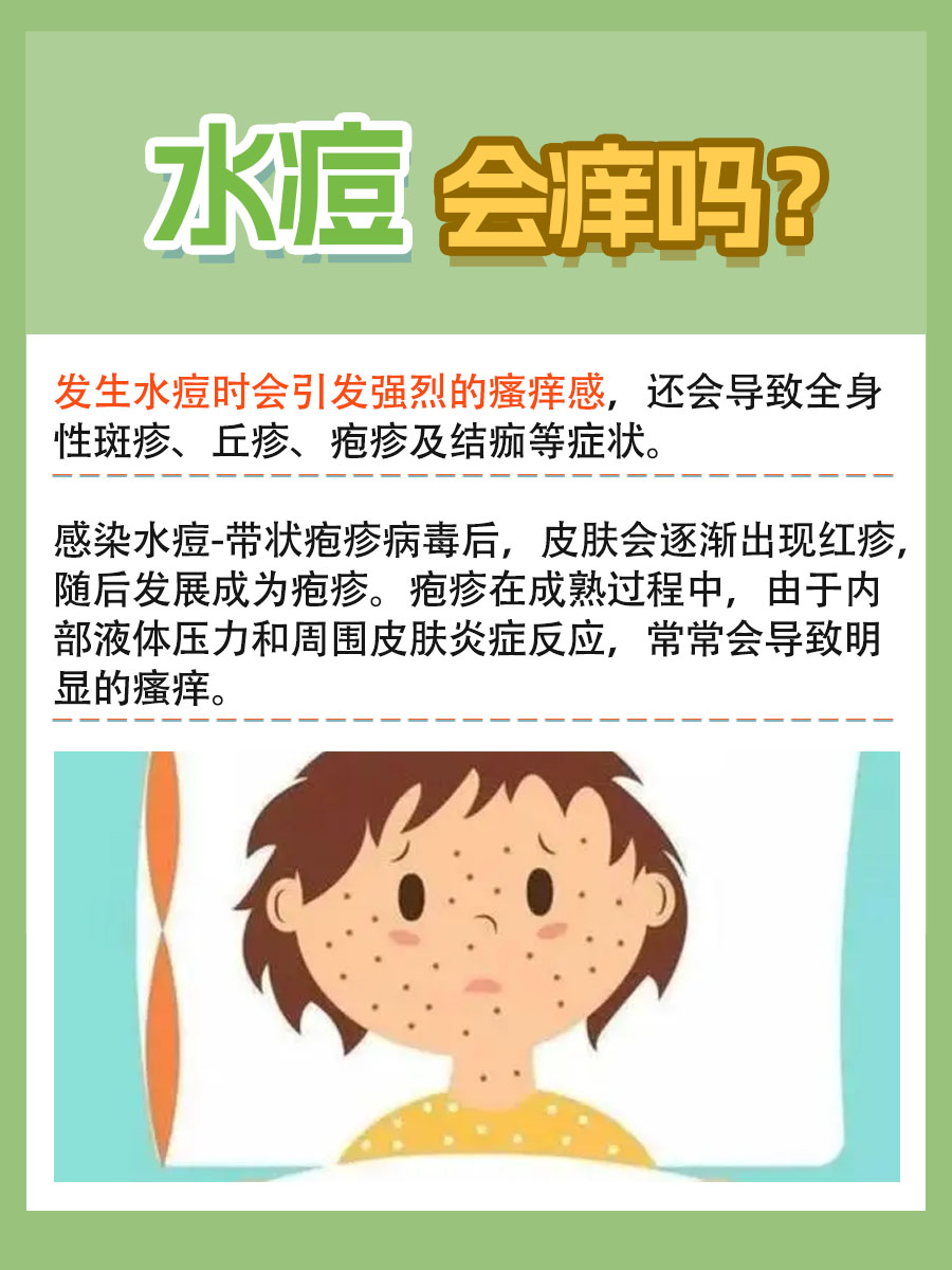 水痘会痒吗？一文带你了解