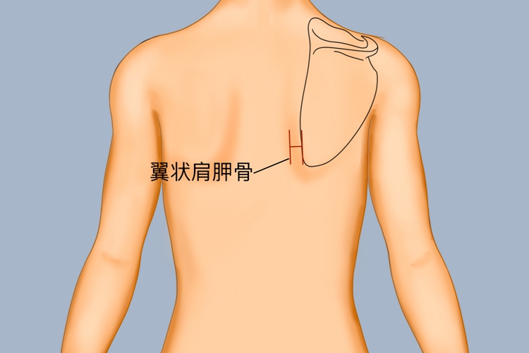 翼状肩胛骨图