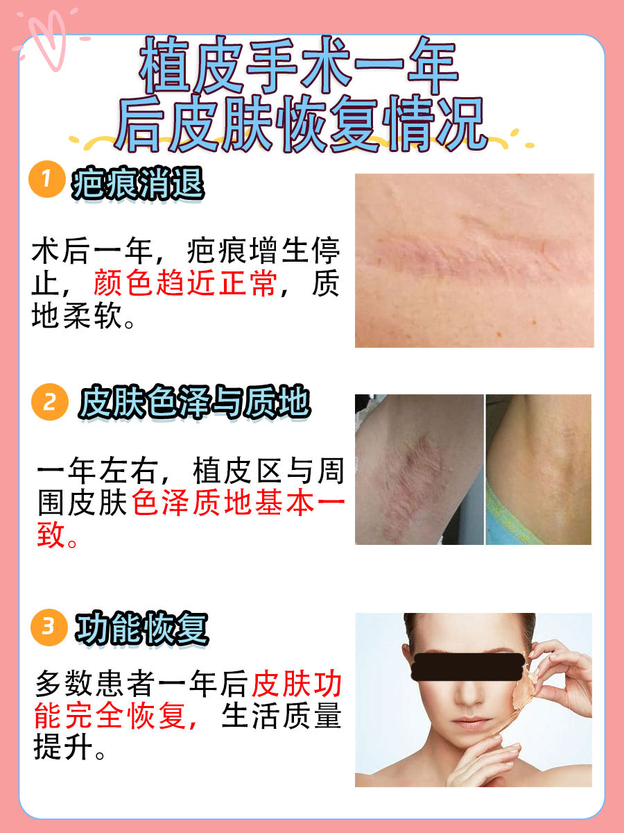 植皮一年后恢复图片对比