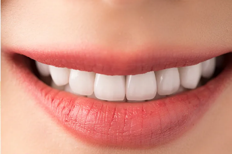 异常牙齿磨平后图