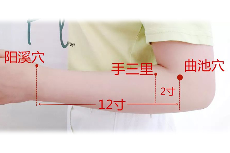 手麻拔罐手三里穴位置图