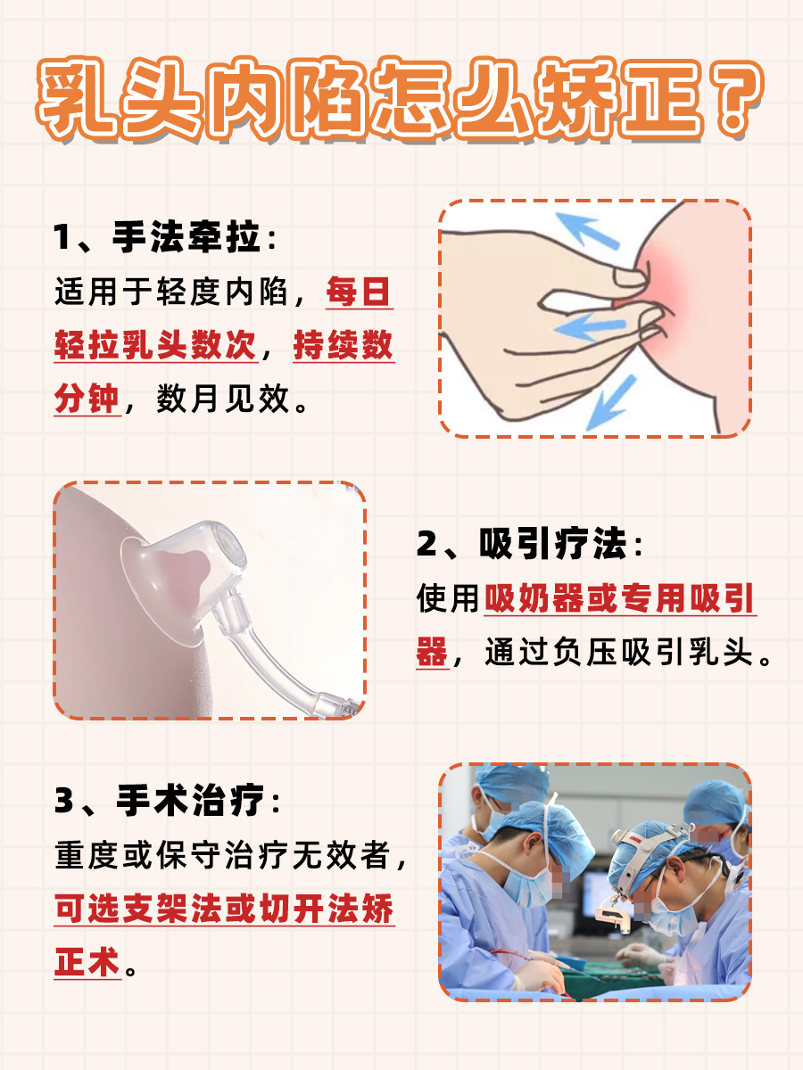 乳头内陷：教你矫正方法