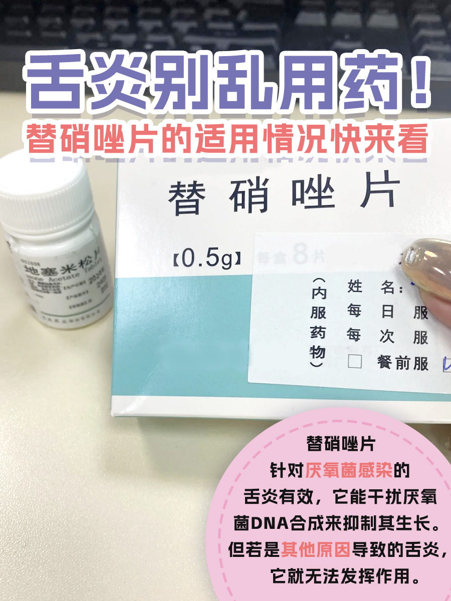 舌炎别乱用药!替硝唑片的适用情况快来看