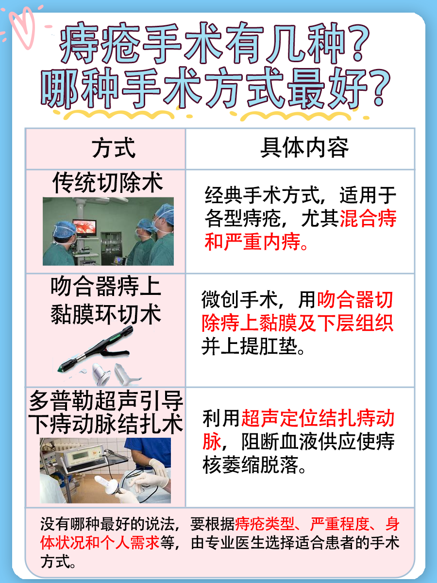 痔疮手术：方法有几种？哪种最好？