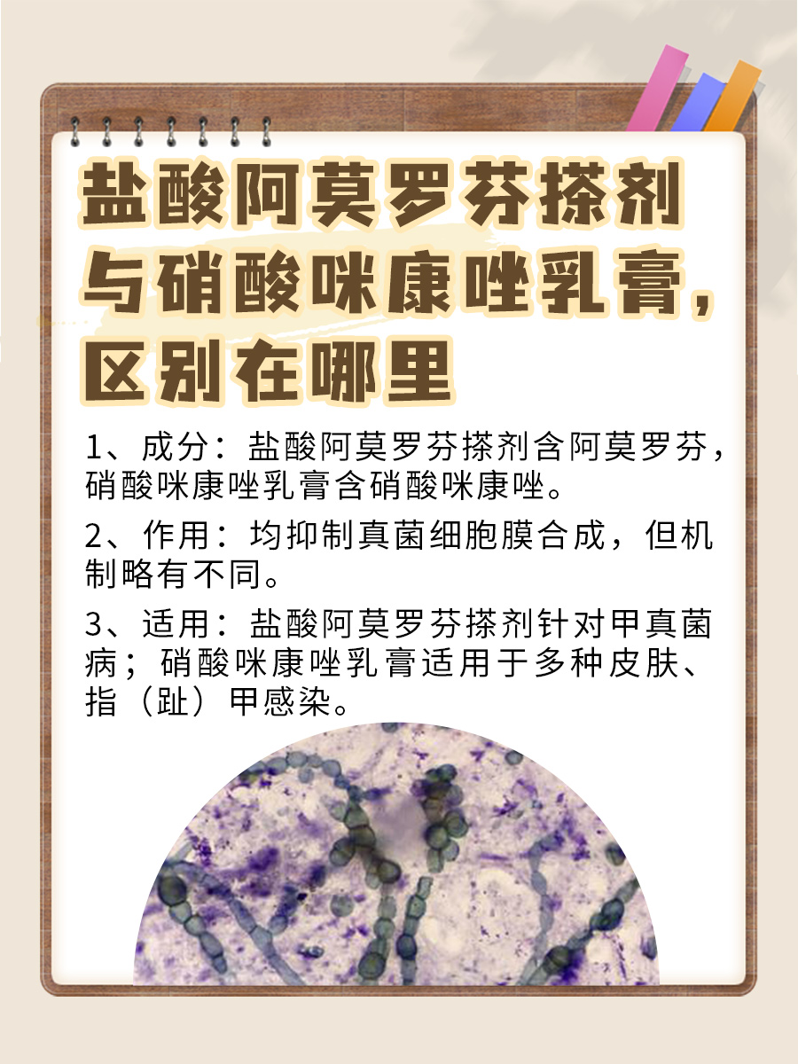 盐酸阿莫罗芬搽剂与硝酸咪康唑乳膏，区别在哪里