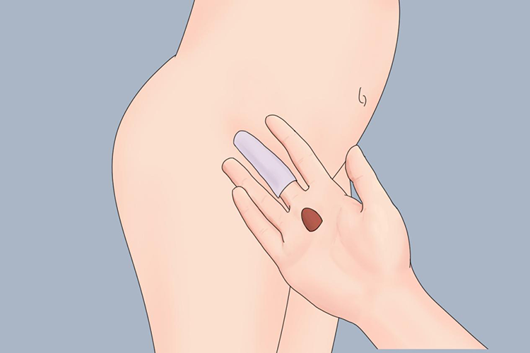 带上指套放置栓剂图