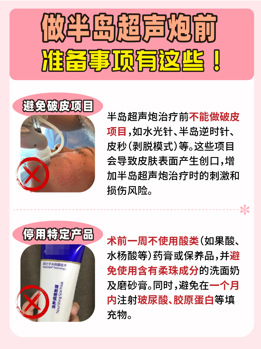 速看!一文带你了解半岛超声炮!