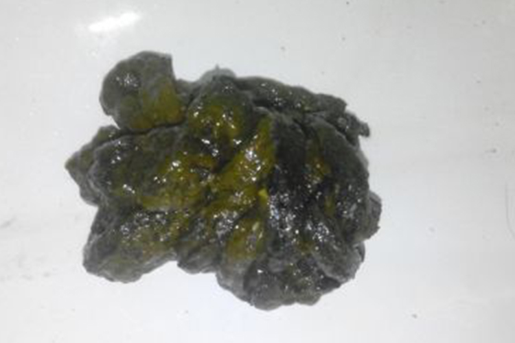 黑色便图 黑色便图