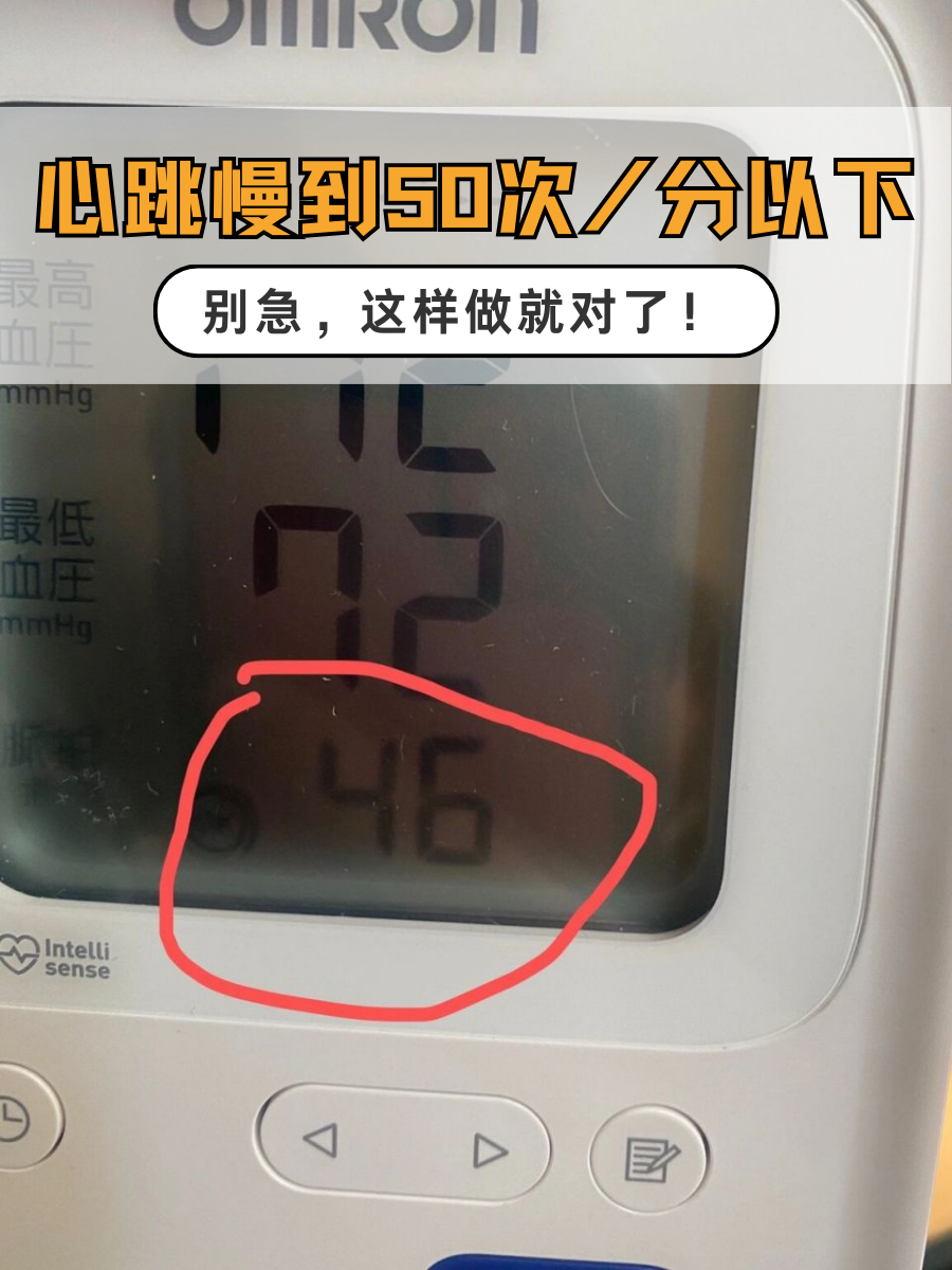 心跳慢到50次/分以下，别急，这样做就对了！