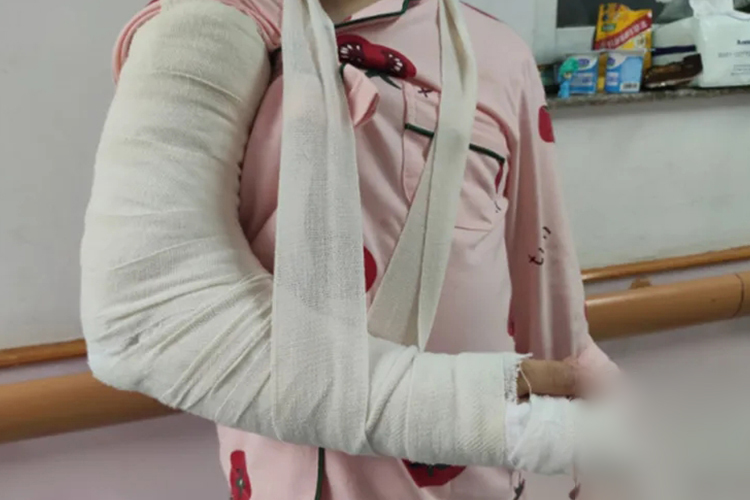 肘关节石膏固定图