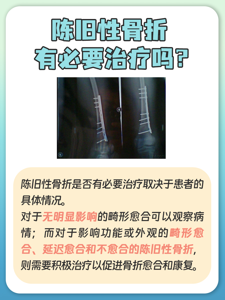 陈旧性骨折有必要治疗吗？一文说清