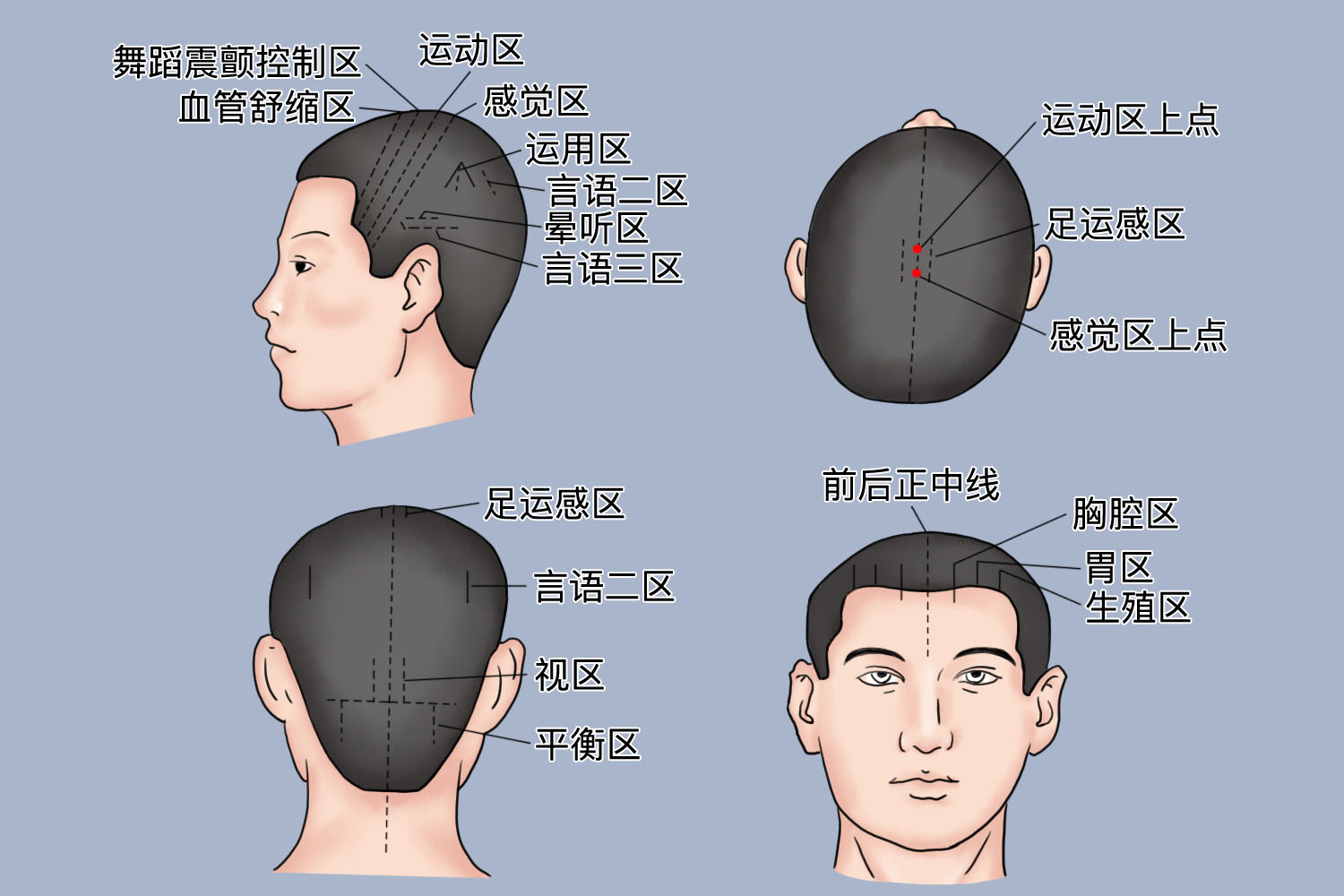 头针语言区图解图片