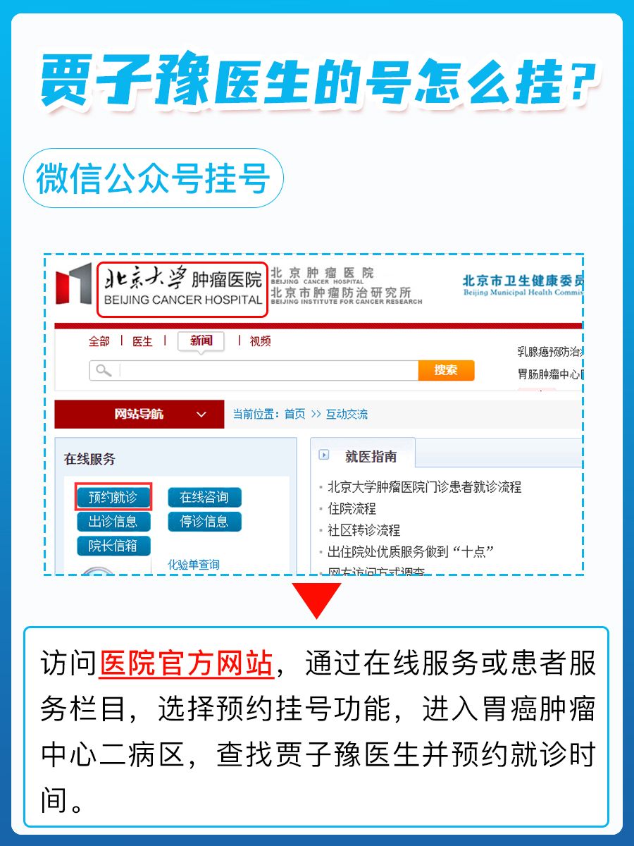北京大学肿瘤医院贾子豫医生怎么样？怎么挂号？