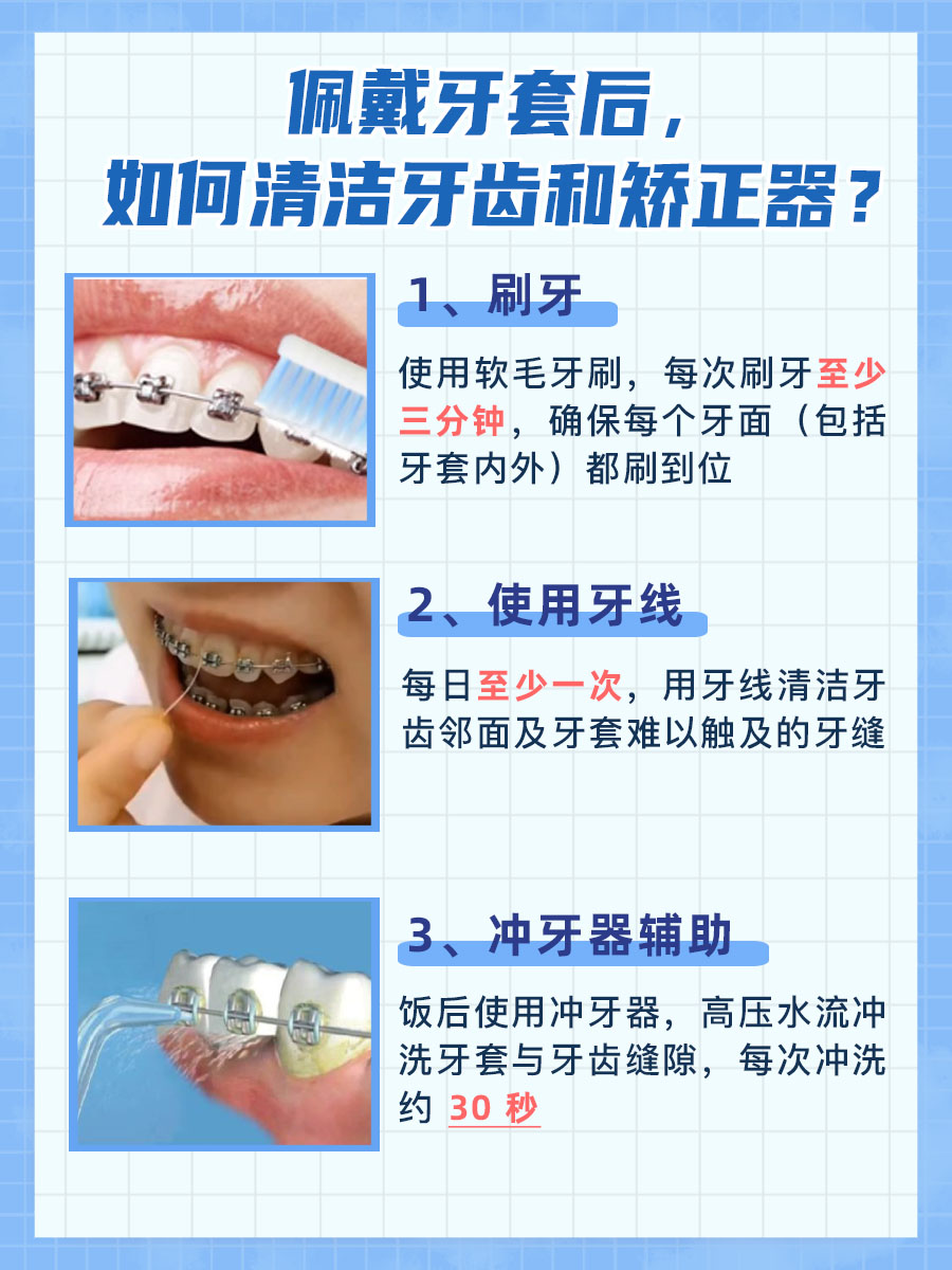 牙齿地包天的矫正与最佳时间，你知道吗？