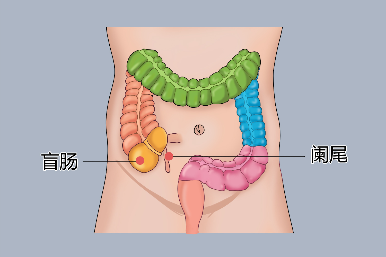 盲肠和阑尾位置图
