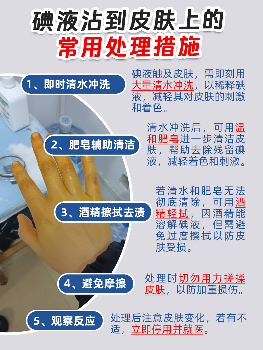 碘液弄到皮肤上?别担心!教你轻松应对