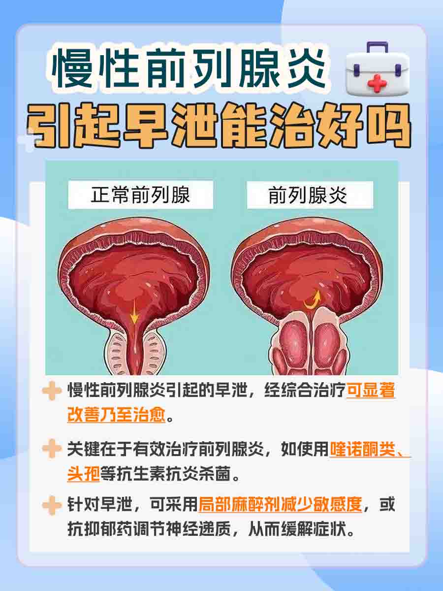 慢性前列腺炎引起早些泄能治好吗？揭秘