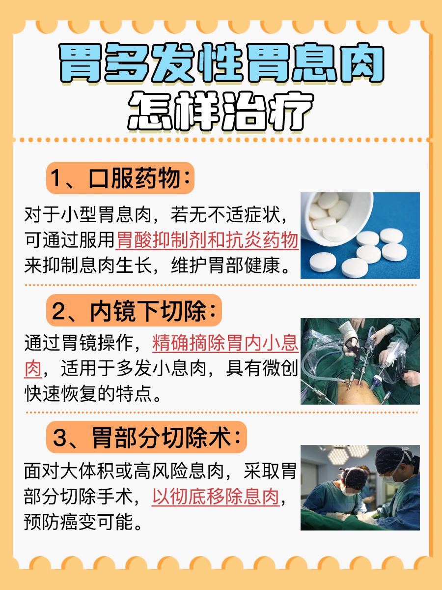 多发性胃息肉治疗攻略，告别胃部隐患