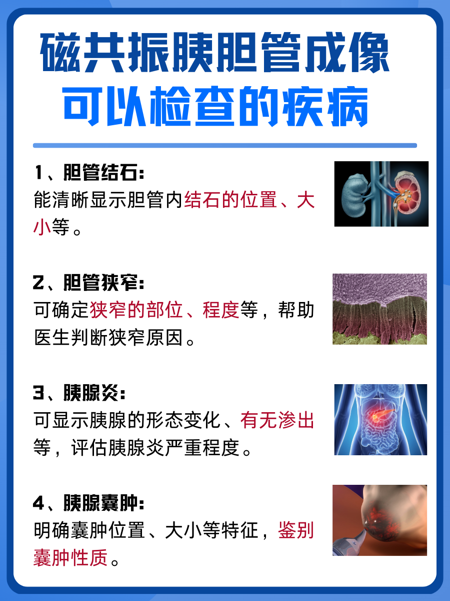 MRCP检查费用一览：磁共振胰胆管成像多少钱