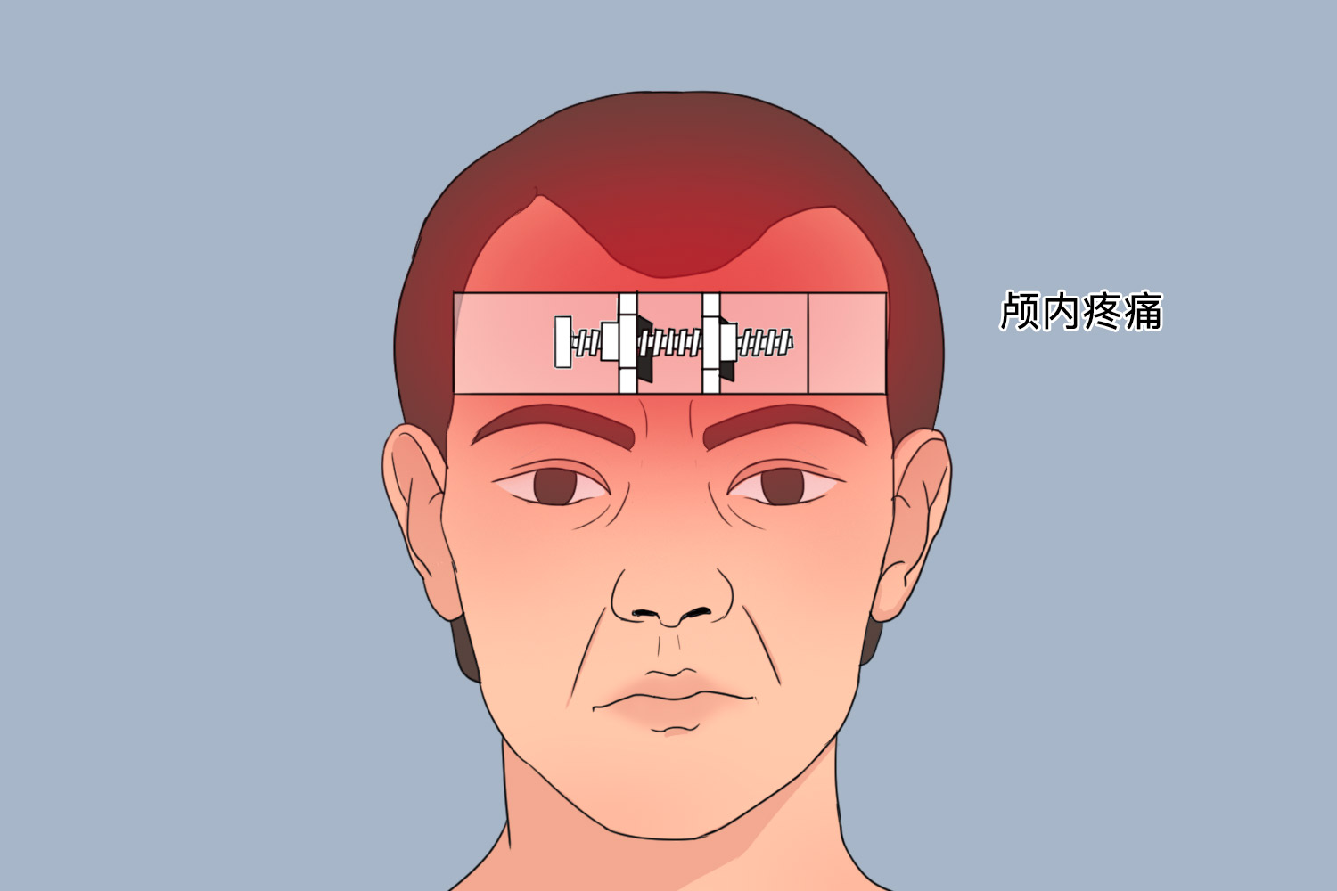 少阴头痛位置图