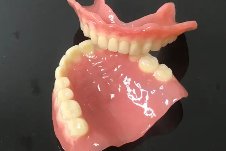 吸附性义齿图 吸附性义齿图